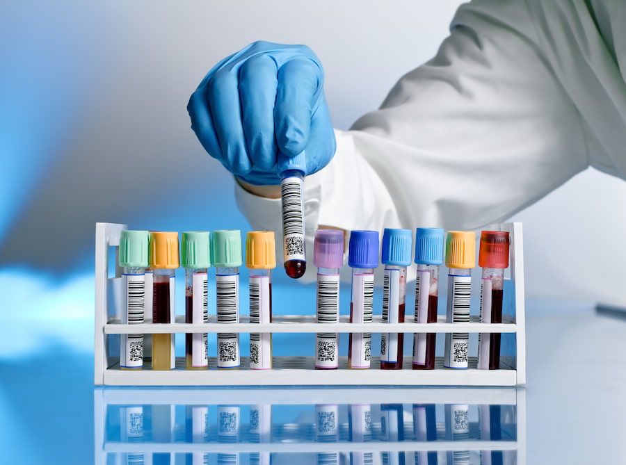 prueba-detectar-sustancias